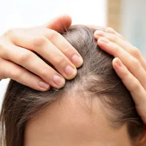 פותחים יום בערוץ 13-אלופציה אראטה